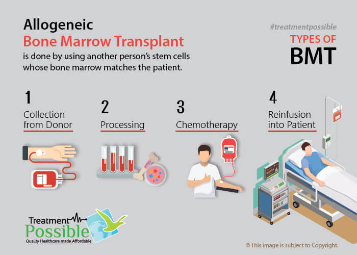 allogeneic stem cell transplant precautions allogeneic stem cell transplant precautions