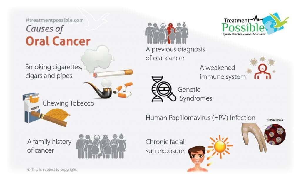 An infographic show list of causes of oral cancer in adults