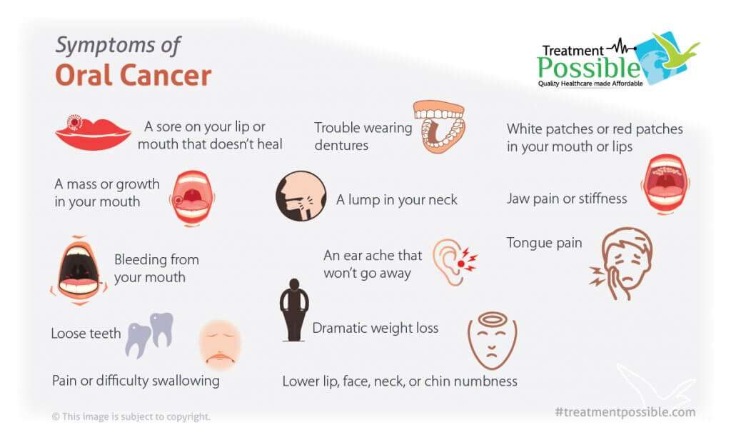 An infographic showing the diffrent symptoms of mouth cancer