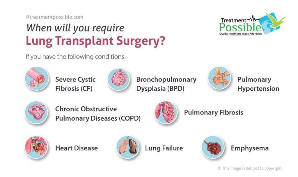 The infographic lists various diseases that may require a lung transplant for treatment