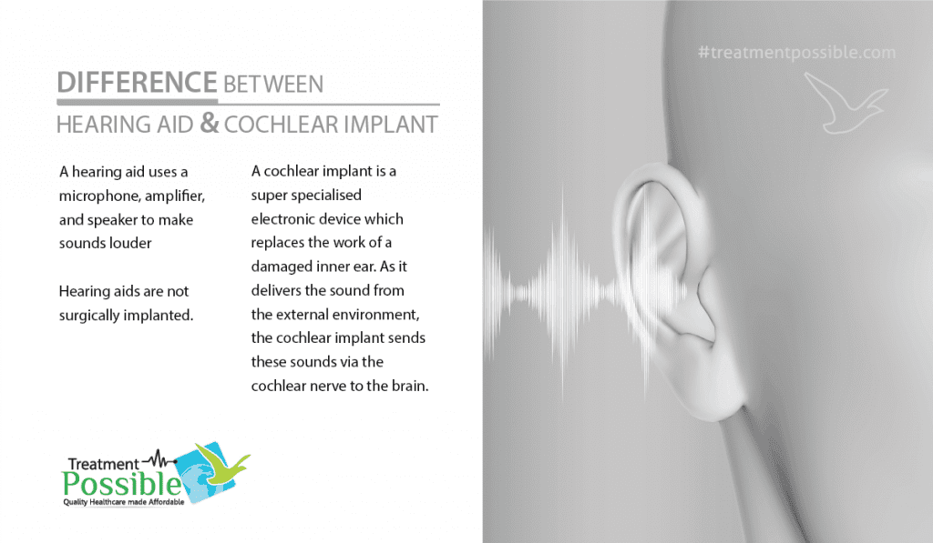 Difference between hearing aid and cochlear implant