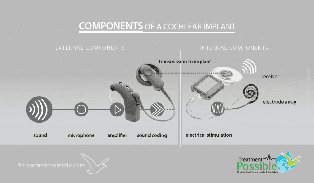 Components of a cochlear implant