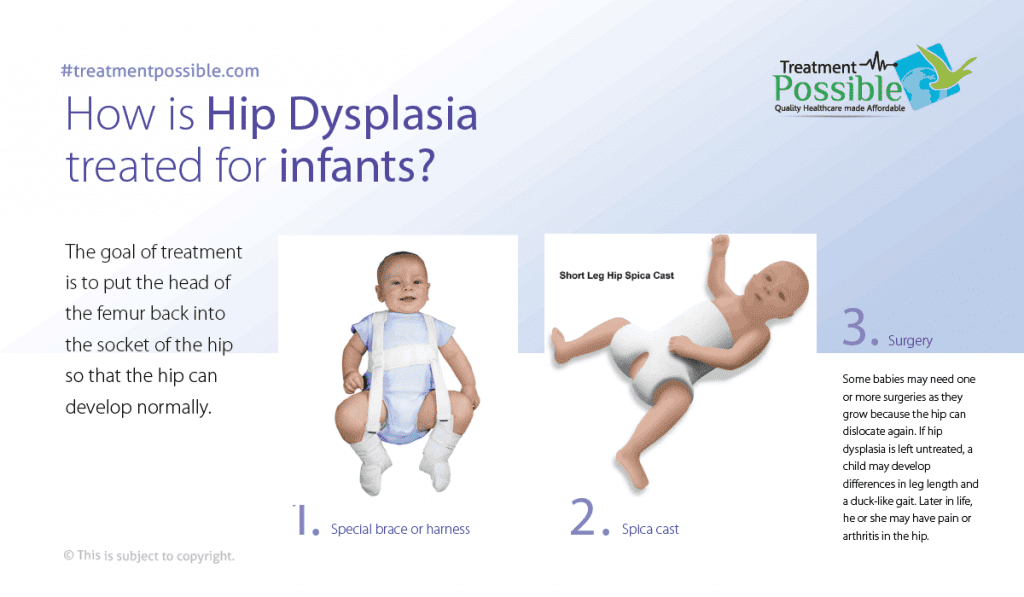 congenital hip dysplasia treatment in india