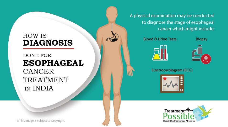 esophagael cancer diagnosed