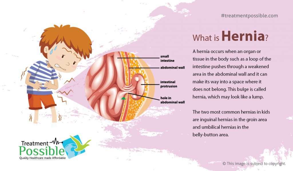 Pediatric hernia treatment in india