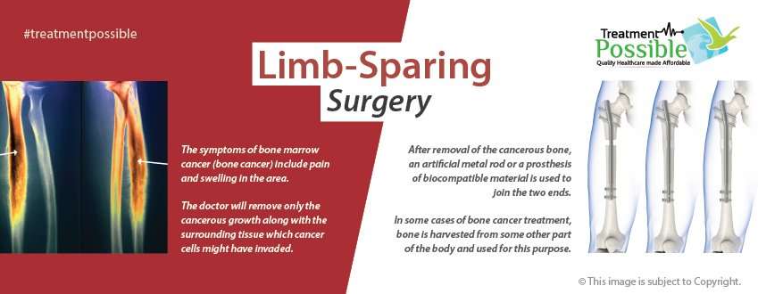 Limb sparing surgery