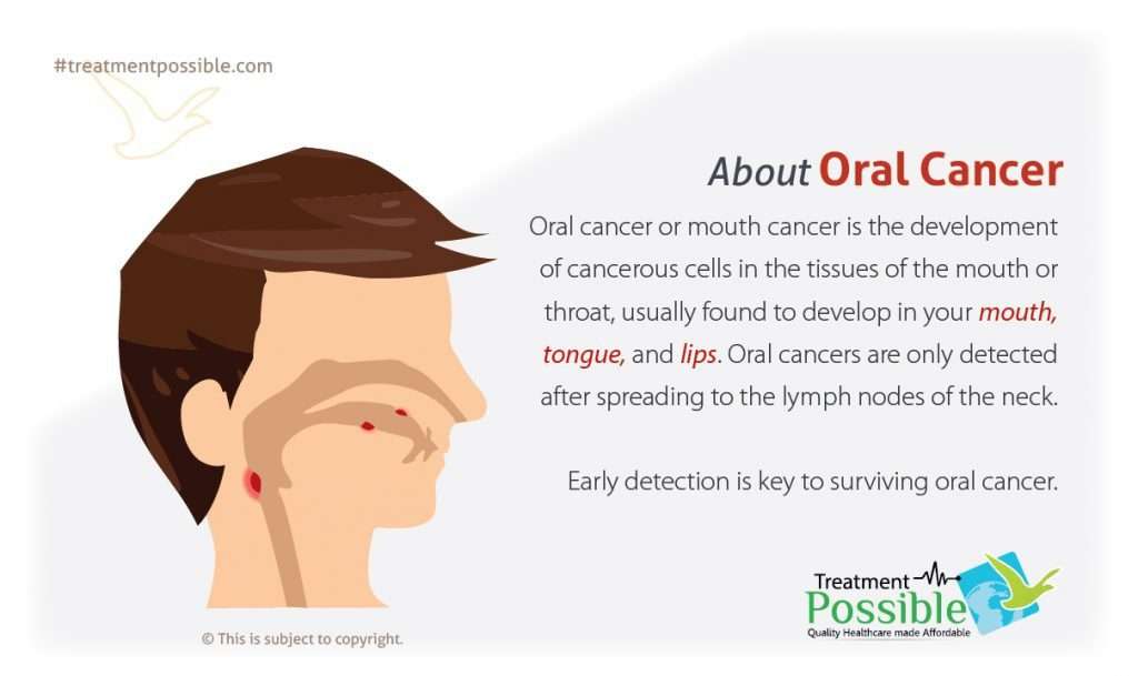 about oral cancer