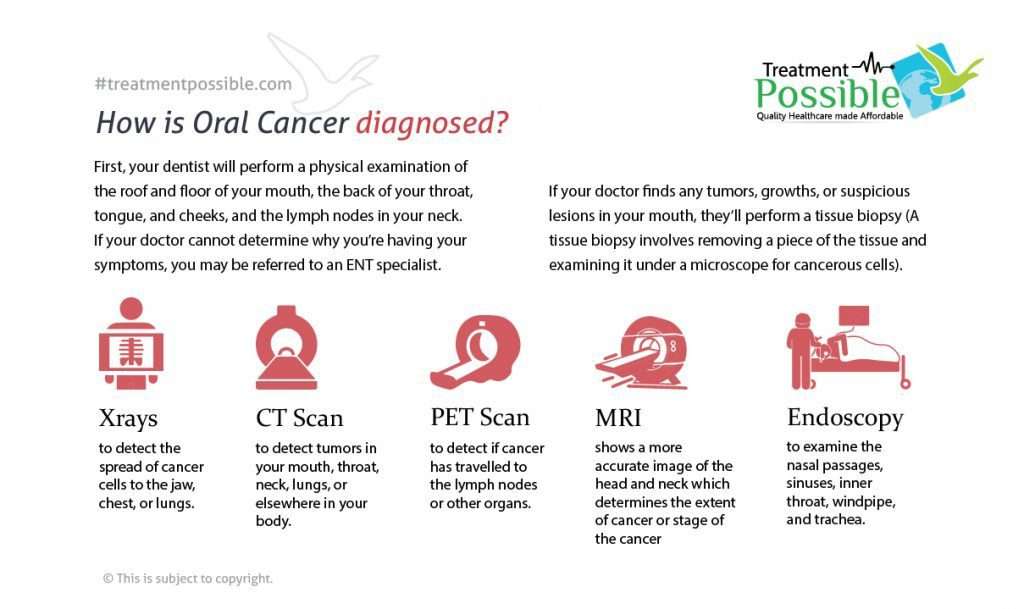 oral cancer diagnosed