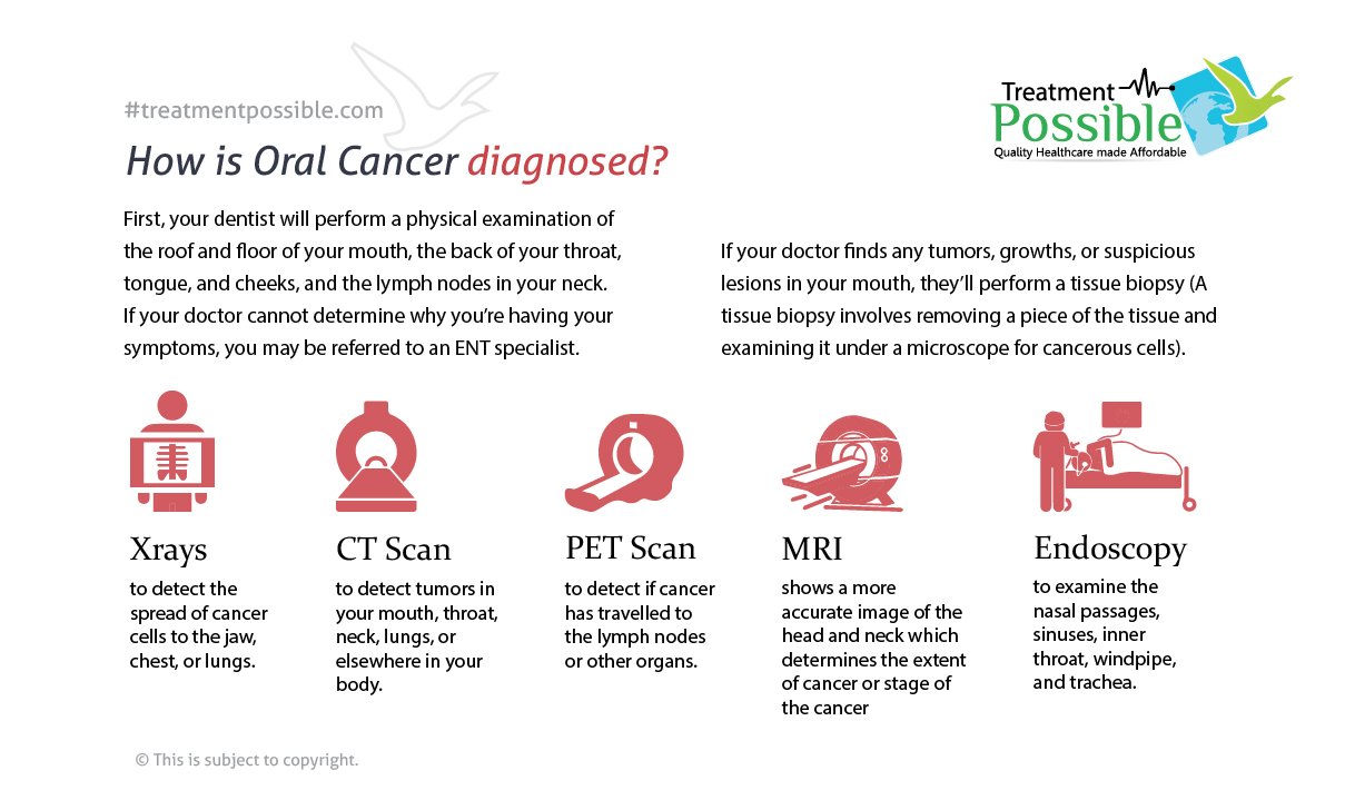 Oral Cancer Treatment Treatment Possible
