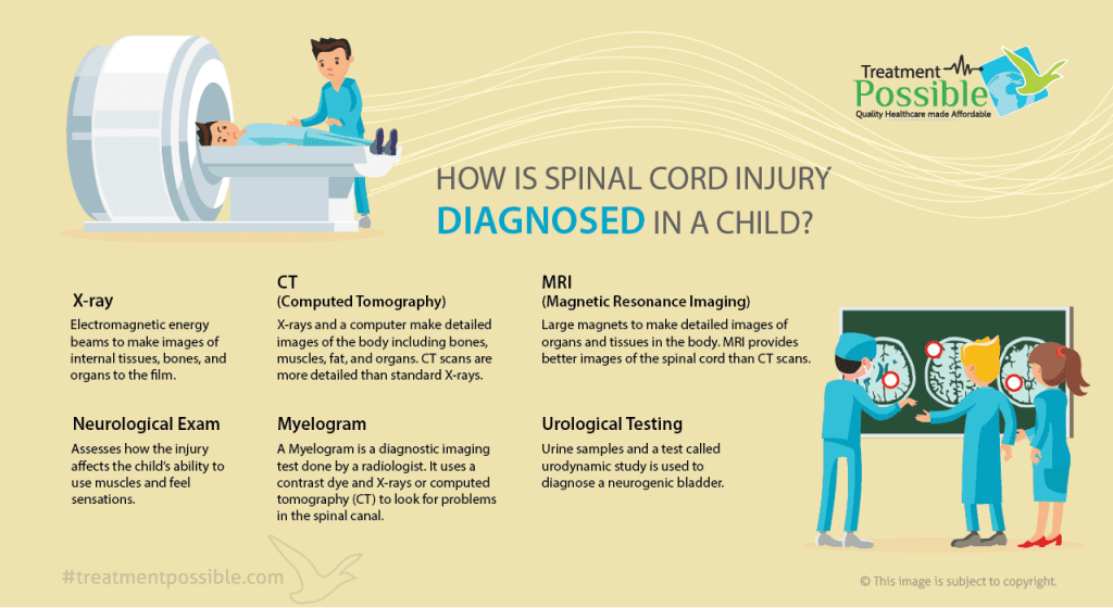Spinal cord injury diagnosed in child